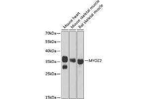 Western blot analysis of extracts of various cell lines, using MYOZ2 antibody (ABIN6129772, ABIN6144299, ABIN6144300 and ABIN6222126) at 1:1000 dilution. (MYOZ2 anticorps  (AA 1-264))
