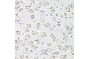 Immunohistochemistry of paraffin-embedded mouse brain using Albumin antibody (ABIN3020953, ABIN3020954, ABIN3020955 and ABIN6213817) at dilution of 1:100 (40x lens).