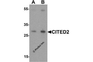 Western Blotting (WB) image for anti-Cbp/p300-Interacting Transactivator, with Glu/Asp-Rich Carboxy-terminal Domain, 2 (CITED2) (N-Term) antibody (ABIN1077387) (CITED2 anticorps  (N-Term))
