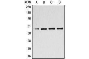Western blot analysis of B4GALT3 expression in Jurkat (A), HL60 (B), HeLa (C), COLO205 (D) whole cell lysates.
