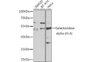 Western blot analysis of extracts of various cell lines, using Galactosidase alpha (Galactosidase alpha (GLA)) antibody (ABIN6131511, ABIN6141114, ABIN6141116 and ABIN6218799) at 1:1000 dilution. (GLA anticorps  (AA 150-429))