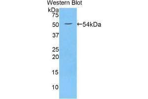 Western blot analysis of the recombinant protein. (WNT10A anticorps  (AA 108-343))