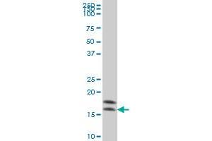 NME2 monoclonal antibody (M06), clone 1D3 Western Blot analysis of NME2 expression in HeLa .
