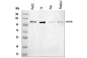 Western blot analysis of DDX58 using anti-DDX58 antibody (ABIN5518906).