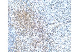 Immunohistochemistry (IHC) image for anti-CD28 (CD28) (AA 170-220) antibody (ABIN7455122) (Recombinant CD28 anticorps  (AA 170-220))