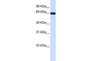 WB Suggested Anti-LMOD1 Antibody Titration: 0. (Leiomodin 1 anticorps  (N-Term))
