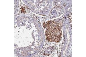 Immunohistochemical staining of human testis with ABCA8 polyclonal antibody  shows strong cytoplasmic and membranous positivity in Leydig cells at 1:50-1:200 dilution. (ABCA8 anticorps)