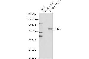 Immunoprecipitation analysis of 200 μg extracts of SW620 cells using 3 μg ETV6 antibody (ABIN3022302, ABIN3022303, ABIN3022304, ABIN1512878 and ABIN6218719).