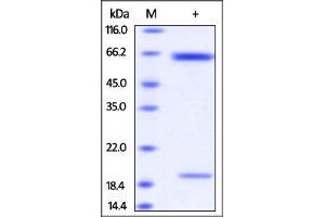 Rat PCSK9, His Tag on SDS-PAGE under reducing (R) condition.