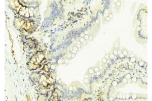 ABIN6274654 at 1/100 staining Mouse colon tissue by IHC-P. (CYP2W1 anticorps  (Internal Region))