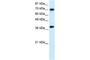 WB Suggested Anti-TCEA1 Antibody Titration:  0. (TCEA1 anticorps  (N-Term))