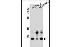 GFRA4 Antibody (Center) (ABIN657173 and ABIN2837905) western blot analysis in HL-60,ZR-75-1,MDA-M cell line lysates (35 μg/lane). (GFRA4 anticorps  (AA 156-184))