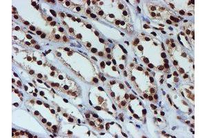 Image no. 14 for anti-Fragile X Mental Retardation 1 (FMR1) antibody (ABIN1498287)