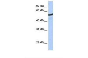 anti-Malic Enzyme 3, NADP(+)-Dependent, Mitochondrial (ME3) (AA 38-87) antibody