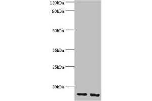 Western blot All lanes: E3 ubiquitin-protein ligase RBX1 antibody at 4 μg/mL Lane 1: Hela whole cell lysate Lane 2: HepG2 whole cell lysate Secondary Goat polyclonal to rabbit IgG at 1/10000 dilution Predicted band size: 12 kDa Observed band size: 12 kDa (RBX1 anticorps  (AA 1-108))