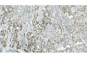 IHC analysis of IL37 using anti-IL37 antibody (ABIN7601794). (IL-37 anticorps  (AA 46-218))