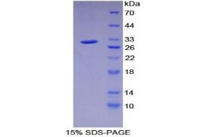 SDS-PAGE analysis of Human PRKAg1 Protein. (PRKAG1 Protéine)
