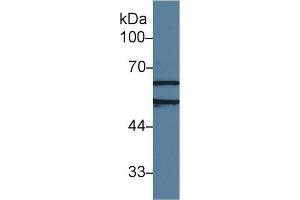 Western Blot; Sample: Human Jurkat cell lysate; Primary Ab: 1µg/ml Rabbit Anti-Rat AchE Antibody Second Ab: 0. (Acetylcholinesterase anticorps  (AA 157-332))