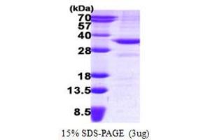SDS-PAGE (SDS) image for 3-hydroxybutyrate Dehydrogenase, Type 1 (BDH1) (AA 47-343) protein (His tag) (ABIN7279653)