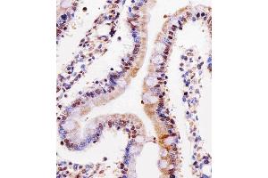 Immunohistochemical analysis of paraffin-embedded rat small intestine section using Rat Cdk4 Antibody (C-term) B.