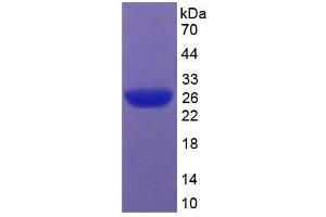 SDS-PAGE analysis of Rat Caspase 9 Protein. (Caspase 9 Protéine)