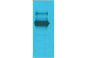 Western Blotting (WB) image for anti-LexA DNA Binding Region antibody (ABIN3181558) (LexA DNA Binding Region anticorps)