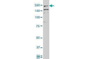 FER1L3 polyclonal antibody (A01), Lot # 060529JCS1.