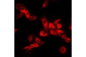 Immunofluorescent analysis of MYL2 staining in MCF7 cells.