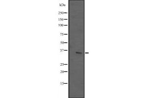 Western blot analysis of ING2 expression in T47-D cell lysate,The lane on the left is treated with the antigen-specific peptide. (ING2 anticorps  (C-Term))