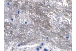 IHC-P analysis of Rat Spinal cord Tissue, with DAB staining. (RANKL anticorps  (AA 106-240))