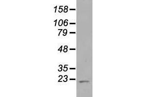 Western blot analysis of 35 µg of cell extracts from human Liver carcinoma (HepG2) cells using anti-AK1 antibody. (Adenylate Kinase 1 anticorps)