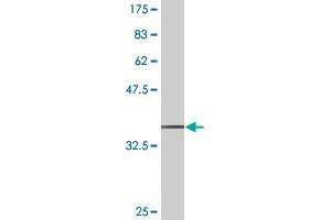 Western Blot detection against Immunogen (36. (SCYL1 anticorps  (AA 373-472))