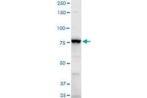 ADD3 polyclonal antibody (A01), Lot # CHI0060725QCS1. (ADD3 anticorps  (AA 462-560))