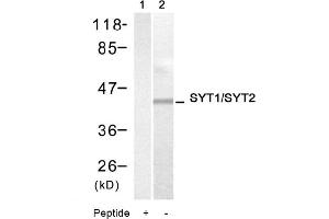Image no. 1 for anti-Synaptotagmin I (SYT1) (Thr199), (Thr202) antibody (ABIN319342) (SYT1 anticorps  (Thr199, Thr202))