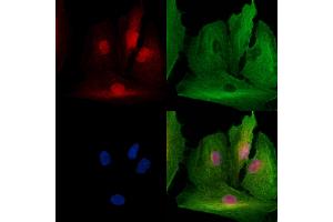 ABIN7094778 and ABIN7098829 staining  cells by IF/ICC. (SSRP1 anticorps  (Internal Region))