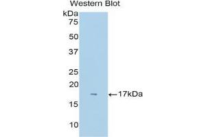 Western blot analysis of the recombinant protein. (Neuropilin 1 anticorps  (AA 27-141))