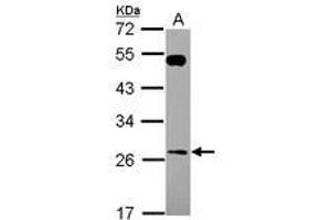 Image no. 1 for anti-RAB26, Member RAS Oncogene Family (RAB26) (AA 53-238) antibody (ABIN1500556) (RAB26 anticorps  (AA 53-238))