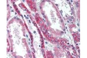 Immunohistochemistry (IHC) image for anti-Tumor Necrosis Factor Receptor Superfamily, Member 11a, NFKB Activator (TNFRSF11A) (AA 603-613) antibody (ABIN2470155)