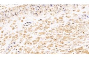 Detection of TNC in Human Placenta Tissue using Monoclonal Antibody to Tenascin C (TNC)