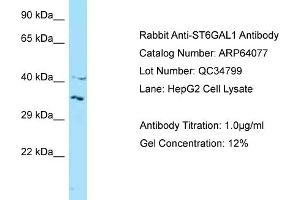 Western Blotting (WB) image for anti-ST6 beta-Galactosamide alpha-2,6-Sialyltranferase 1 (ST6GAL1) (N-Term) antibody (ABIN971799) (ST6GAL1 anticorps  (N-Term))