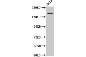 Western Blot Positive WB detected in: Hela whole cell lysate All lanes: ROBO1 antibody at 3. (ROBO1 anticorps  (AA 29-143))