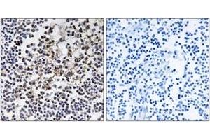 Immunohistochemistry analysis of paraffin-embedded human lymph node tissue, using PGLS Antibody.