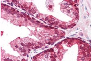 Human Prostate: Formalin-Fixed, Paraffin-Embedded (FFPE)