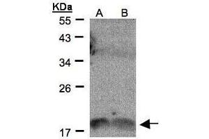 WB Image Sample(30 μg of whole cell lysate) A:H1299 B:HeLa S3, 12% SDS PAGE antibody diluted at 1:500