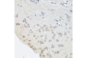 Immunohistochemistry of paraffin-embedded mouse brain using PUM1 antibody at dilution of 1:100 (40x lens). (PUM1 anticorps)