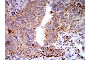 Immunohistochemistry (IHC) image for anti-Toll-Like Receptor 9 (TLR9) (AA 868-1016) antibody (ABIN5896728) (TLR9 anticorps  (AA 868-1016))