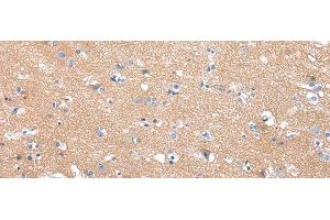Immunohistochemistry of paraffin-embedded Human brain tissue using COLEC12 Polyclonal Antibody at dilution 1:40