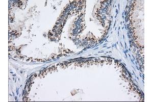 Immunohistochemical staining of paraffin-embedded Human Kidney tissue using anti-MOBKL1A mouse monoclonal antibody. (MOBKL1A anticorps)