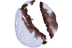 Urinary bladder urothelium Strong Upk1A immunostaining of the urothelium