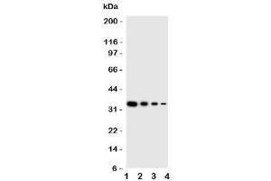 Western blot testing of PKR antbody (EIF2AK2 anticorps  (N-Term))